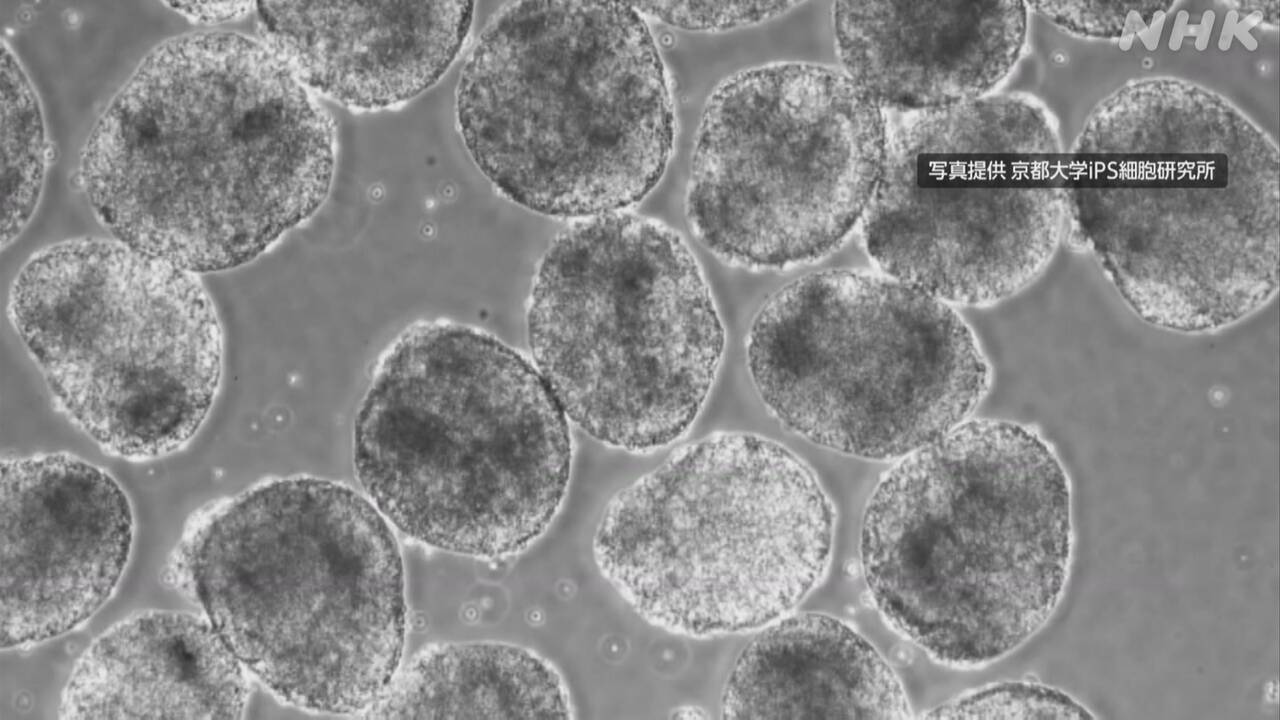 iPS細胞を使った治療専門家が認める